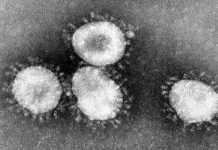 Coronavirus, tra eccessi di allarmismo e rassicurazioni poco convincenti – intervista al prof. Massimo Ciccozzi Coronavirus